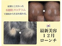 日本初導入◎韓国では20代から当たり前の最新美容　ボリューム