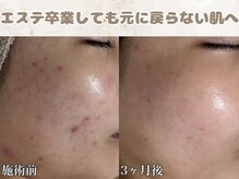 あなたにとって肌改善をする最後のお店に