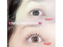 ビュー(V.I.E.W)/MYLAMINATION