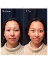 たくろう鍼灸院 豊田本院/Before&After