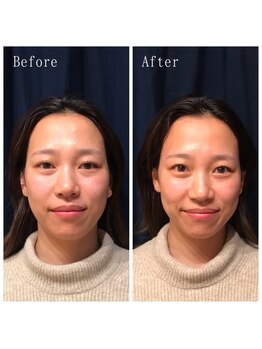 たくろう鍼灸院 豊田本院/Before&After