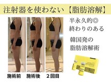 イーズ ミュゼ ららぽーと横浜店