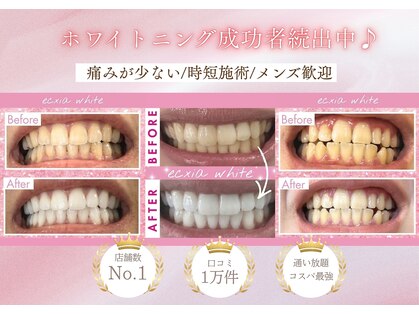 エクシアホワイトニング 八王子店の写真