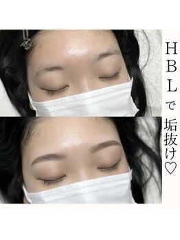 テテ(TeTe)/ハリウッドブロウリフト