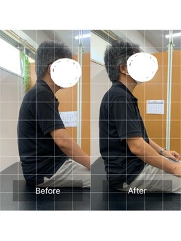 ナオル整体 武蔵小杉院(NAORU整体)/50代男性　腰痛・背中痛