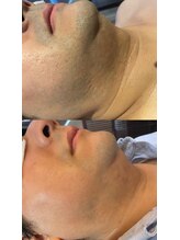 メンズサロン エイチ(H)/年齢問わず人気です！