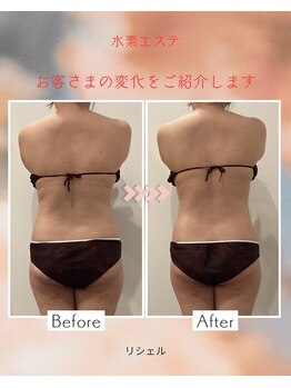 リシェル/ウエスト周り☆ビフォーアフター