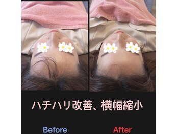 美容矯正サロン レレポノ(LELEPONO)/