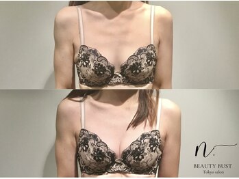 エヌドット 日本橋(N.)/デコルテからバストケア