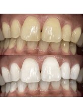 ホワイトニングセンター うるま江洲店/沖縄市・うるま市ホワイトニング