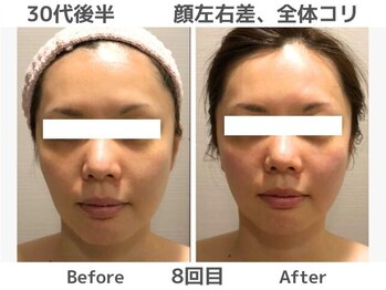 マテリアル(MATERIAL)/お顔の非対称整う