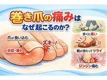 巻き爪じゅん 船橋店/巻き爪の痛みが消える理由とは？