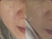 ボーテラボ 大宮(beaute LABO)