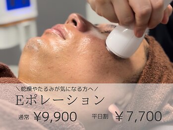 リモア(REMORE)/微弱の電気を流しながら導入！
