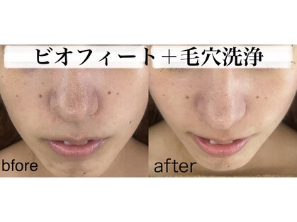 マーレン(Malen)の写真
