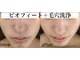 マーレン(Malen)の写真