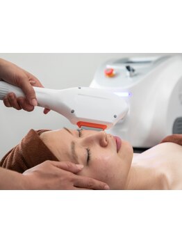 顔脱毛がしたい