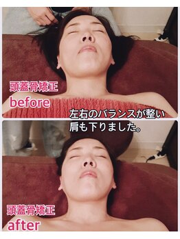 フルールクレール 駒込店/頭蓋骨矯正ビフォアフター