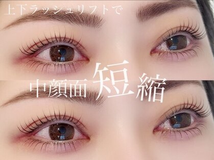 シュシュ(Shu Shu)の写真