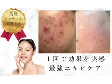 サロンドエクラ 南堀江(salon de eclat)