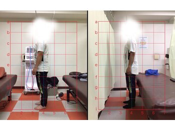 うるおい鍼灸接骨院/ダイエット例1