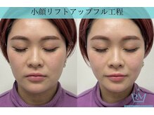 リメイク 広尾(REMAKE)/