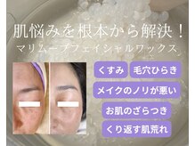 リバース(waxR B S)の雰囲気（フェイシャルワックスでうぶ毛や古い角質をとりツヤ肌へ！）