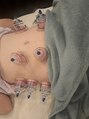 ほぐしま専科 黒岩店 お腹周りのカッピング!ダイエット、血流改善、内蔵の活性化など