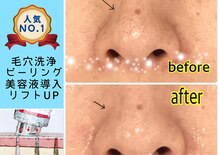 リッシュ(RICHE)