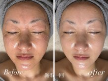 マリエンドリーの雰囲気（肌荒れ・赤ら顔・くすみ・たるみ・むくみ・シワ、も任せ下さい。）