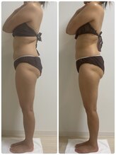 エヌラボ(N.LABO)/痩身