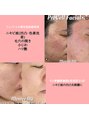 サラシック(salachic)&nbsp;プロセルセラピーズフェイシャル