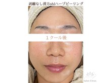 サロンシトロン(Salon.Citron.)の雰囲気（肌悩みが増えてくる今の時期から漢方ハーブで肌育を始めよう♪）