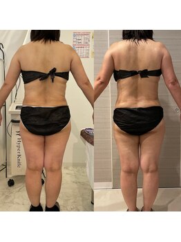 ギャラクシービューティー(galaxy beauty)/深部ボディケア