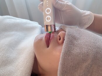 ピュアソル(Puresol)の写真/【黒ずみ悩みに終止符】自信のある肌へ★韓国発の最先端美容"ルメラ"で徹底美白ケア◎ぜひお試しください！