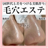 エクラーレ(Eclale)