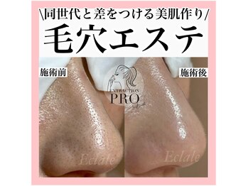 エクラーレ(Eclale)