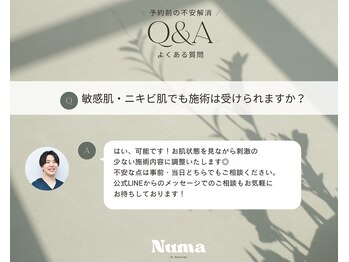 ヌーマ バイ アミーカリーナ(Numa by Amicarina)/よくあるご質問 Q&A