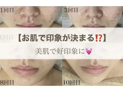 ミセル(MISEL2nd)の写真