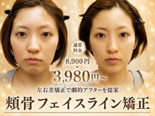 モアフェイス 池袋店(More Face)