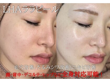 エムラボ 新宿店(M LABO)の写真