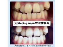 ホワイトニングサロン ホワイト(WHITE)/セルフホワイトニング/大阪/福島