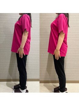 ギャラクシービューティー(galaxy beauty)/肩甲骨はがし