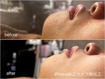 ブロートーキョー 有楽町店(BroTokyo)/月1のシェービングで美肌に!