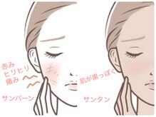 ベルドア(Bell Door)/紫外線ダメージには…