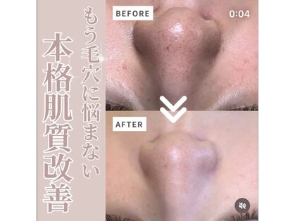 エステティックサロン サクラ(SAKURA)の写真