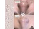 エステティックサロン サクラ(SAKURA)の写真