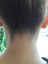 クララビューティー(CLALA Beauty)/襟足のafter