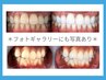 【ホワイトニング回数券】お試し4回コース★1回分プレゼント★￥4,980お得！
