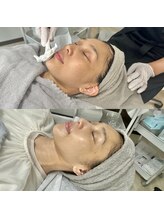 アリス(Alice)/ララピール工程☆7